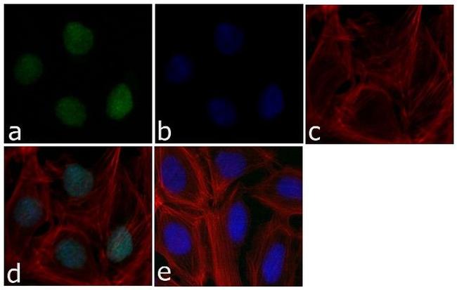 p21 Antibody in Immunocytochemistry (ICC/IF)