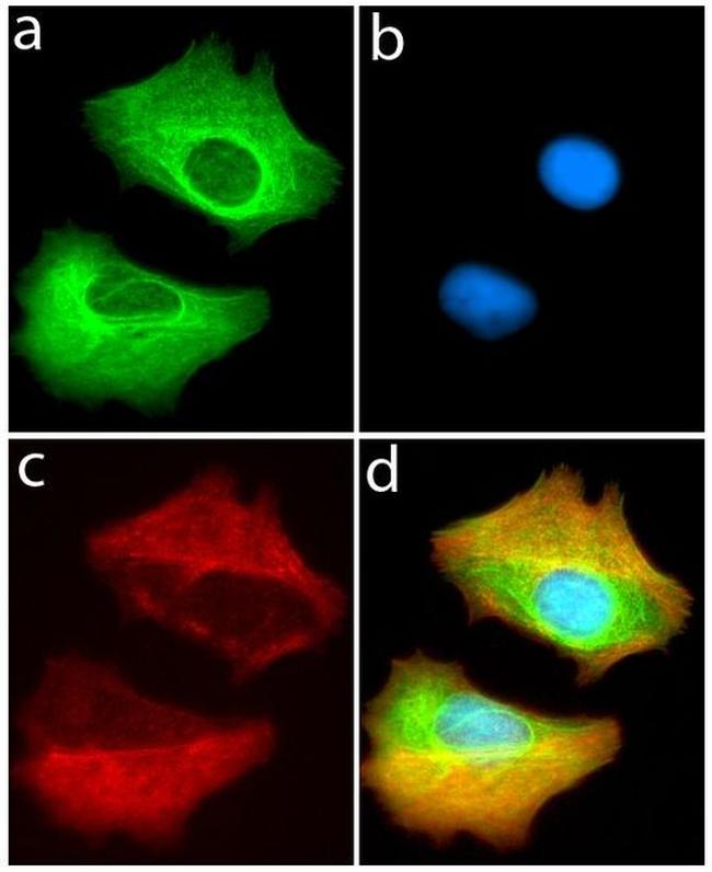 VPS34 Antibody in Immunocytochemistry (ICC/IF)