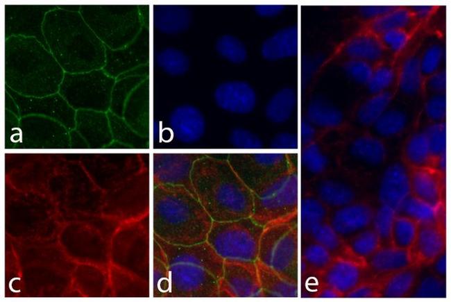 CD49f Antibody in Immunocytochemistry (ICC/IF)