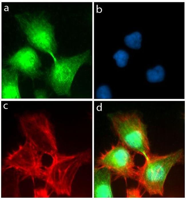 FGFR4 Antibody in Immunocytochemistry (ICC/IF)