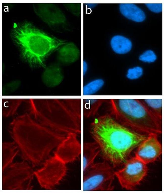 MSI1 Antibody in Immunocytochemistry (ICC/IF)