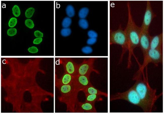 H3K9ac Antibody in Immunocytochemistry (ICC/IF)