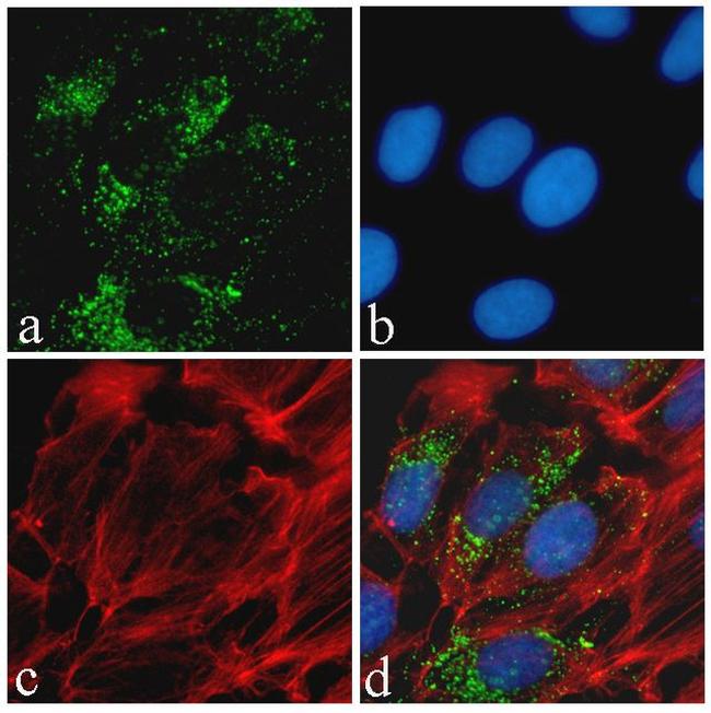 Phospho-Tau (Ser396) Antibody in Immunocytochemistry (ICC/IF)