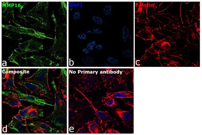 MMP16 Antibody in Immunocytochemistry (ICC/IF)