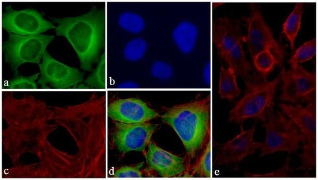 TIMP4 Antibody in Immunocytochemistry (ICC/IF)