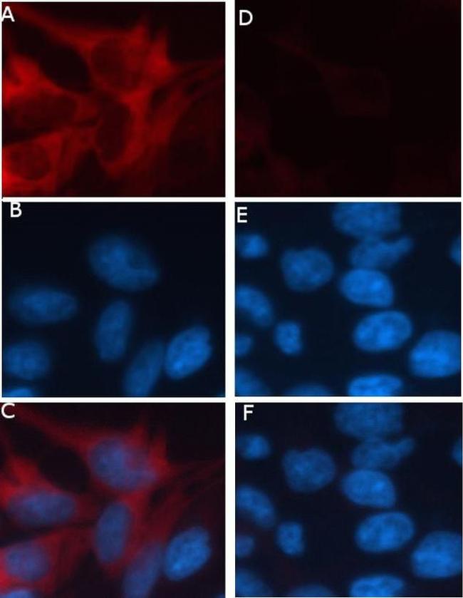 RFP Antibody in Immunocytochemistry (ICC/IF)