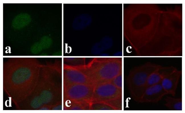 Phospho-SMAD2 (Ser465, Ser467) Antibody in Immunocytochemistry (ICC/IF)