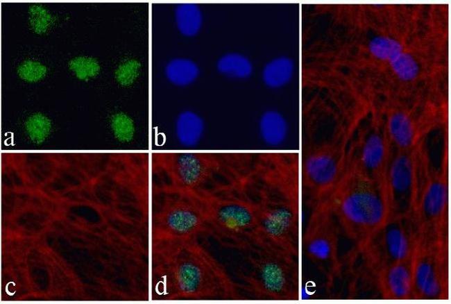 Nkx2.5 Antibody in Immunocytochemistry (ICC/IF)