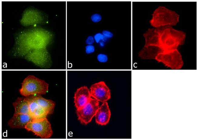 SMAD4 Antibody in Immunocytochemistry (ICC/IF)