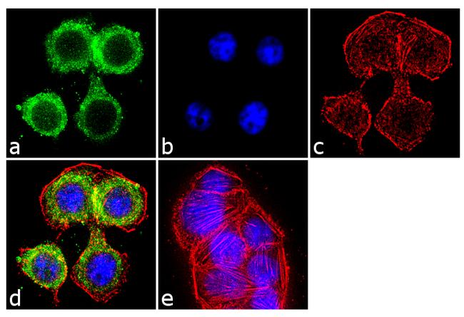 TGFBR2 Antibody in Immunocytochemistry (ICC/IF)