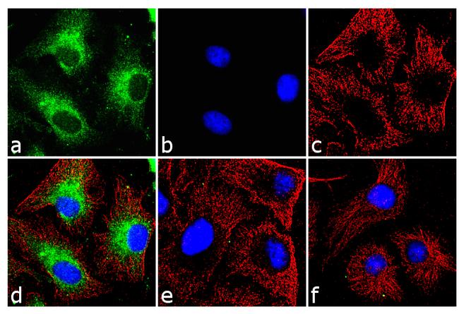 BNIP3 Antibody in Immunocytochemistry (ICC/IF)