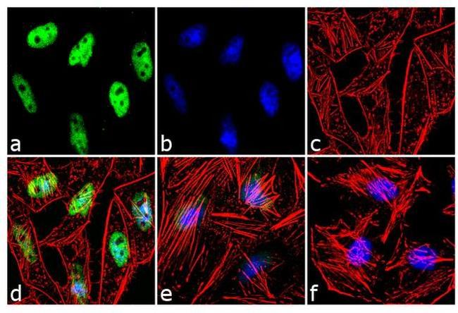 ATR Antibody in Immunocytochemistry (ICC/IF)