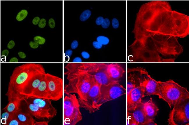 Phospho-IRS1 (Ser616) Antibody in Immunocytochemistry (ICC/IF)