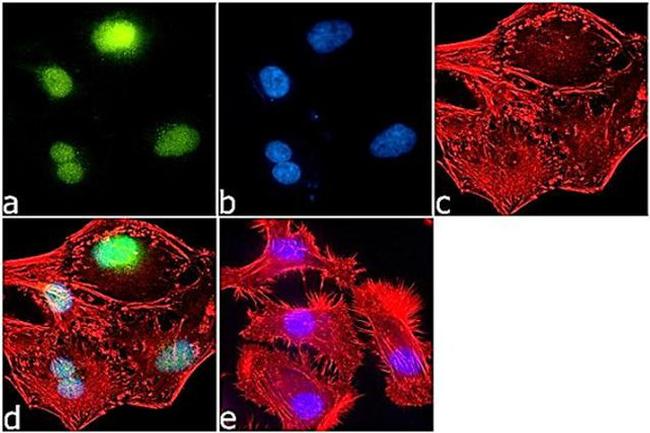 H2BK5ac Antibody in Immunocytochemistry (ICC/IF)