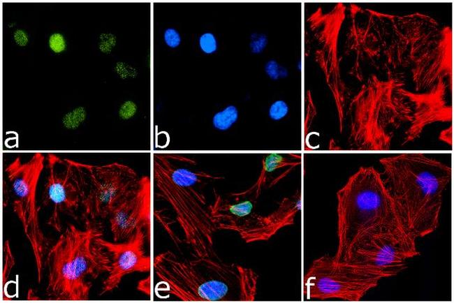 H4K12ac Antibody in Immunocytochemistry (ICC/IF)