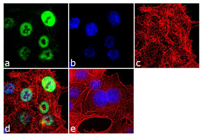 RNF20 Antibody in Immunocytochemistry (ICC/IF)