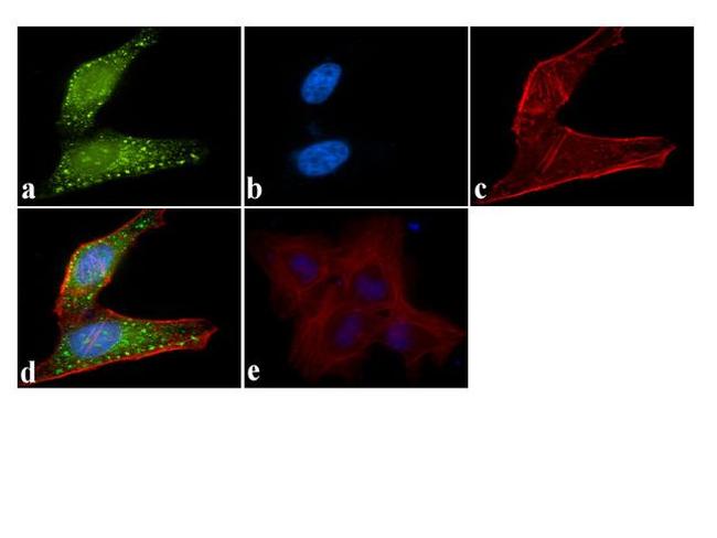 ATG4B Antibody in Immunocytochemistry (ICC/IF)