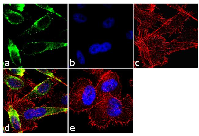 Tyrosine Hydroxylase Antibody in Immunocytochemistry (ICC/IF)