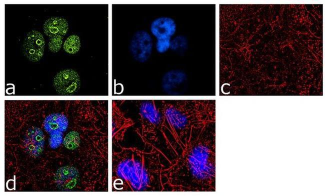 NSUN2 Antibody in Immunocytochemistry (ICC/IF)