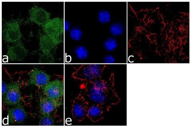 SSTR2 Antibody in Immunocytochemistry (ICC/IF)