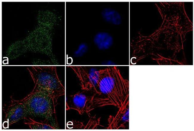 LATS1 Antibody in Immunocytochemistry (ICC/IF)