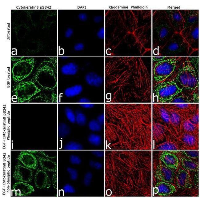 Phospho-Cytokeratin 8 (Ser432) Antibody in Immunocytochemistry (ICC/IF)