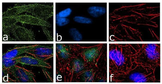 B-Raf Antibody in Immunocytochemistry (ICC/IF)