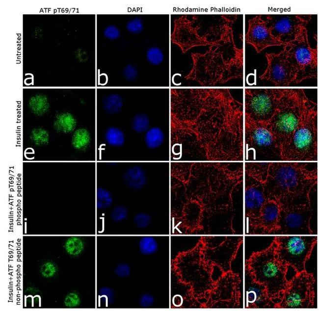 Phospho-ATF2 (Tyr69, Thr71) Antibody in Immunocytochemistry (ICC/IF)