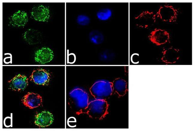 CCR2 Antibody in Immunocytochemistry (ICC/IF)