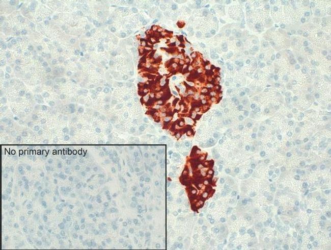 BDKRB2 Antibody in Immunohistochemistry (IHC)