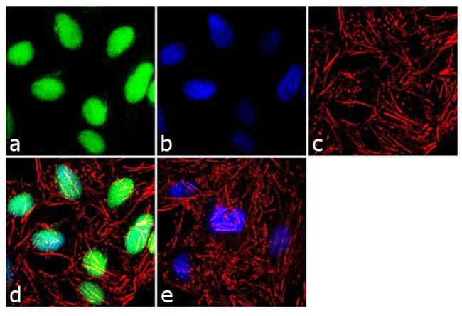 HDAC4 Antibody in Immunocytochemistry (ICC/IF)