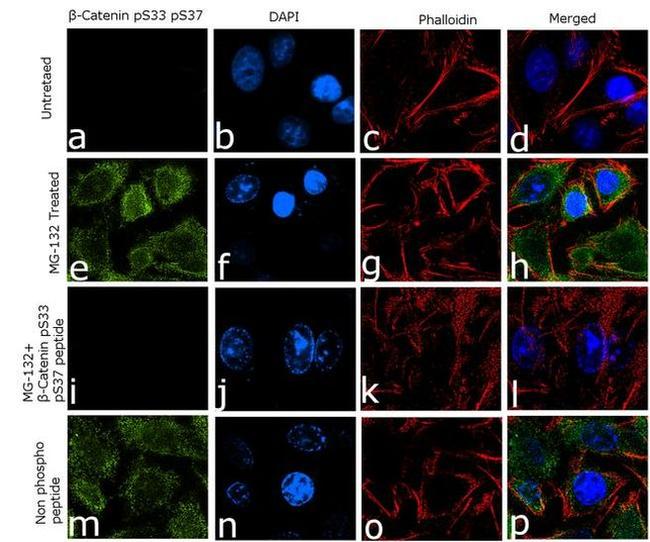 Phospho-beta Catenin (Ser33, Ser37) Antibody in Immunocytochemistry (ICC/IF)