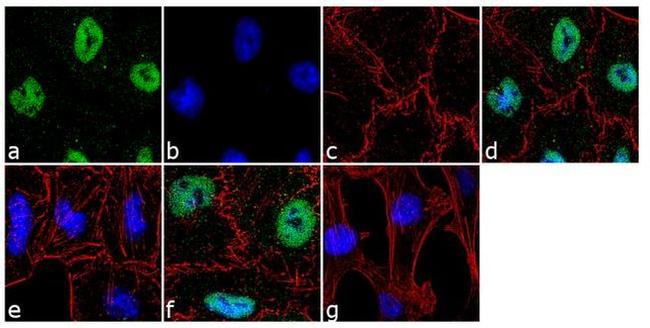 Phospho-Paxillin (Ser178) Antibody in Immunocytochemistry (ICC/IF)