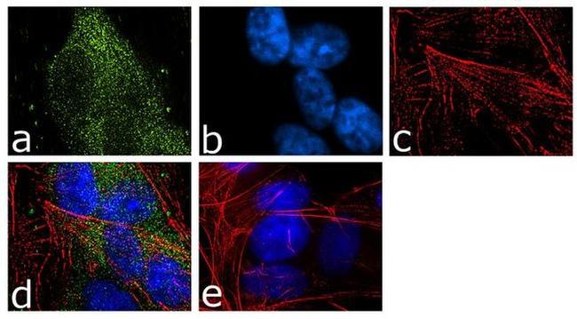 FMRP Antibody in Immunocytochemistry (ICC/IF)