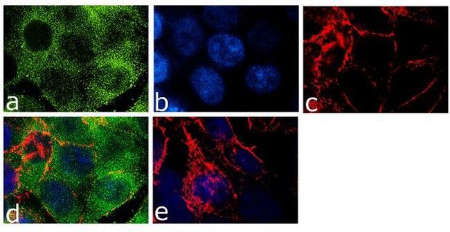 NME1 Antibody in Immunocytochemistry (ICC/IF)