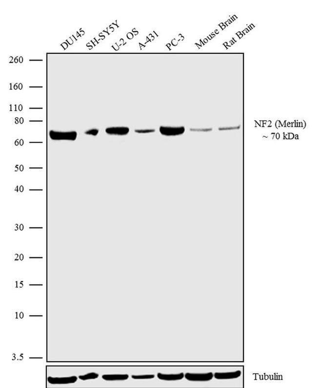 NF2 Antibody in Western Blot (WB)