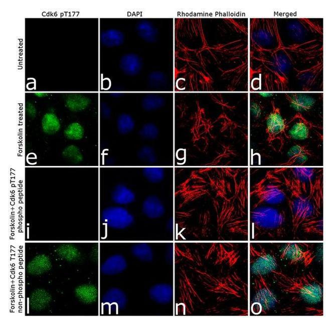 Phospho-CDK6 (Thr177) Antibody in Immunocytochemistry (ICC/IF)