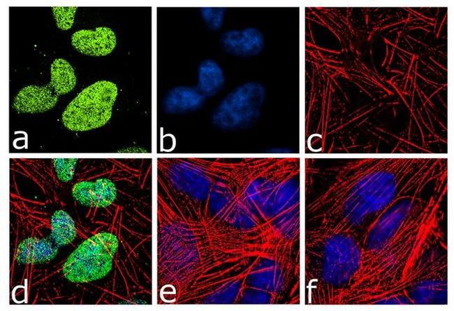 Neurogenin 2 Antibody in Immunocytochemistry (ICC/IF)