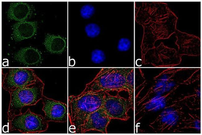 Phospho-PKA alpha/beta (Thr197) Antibody in Immunocytochemistry (ICC/IF)