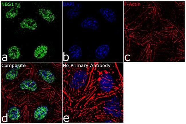 NBS1 Antibody in Immunocytochemistry (ICC/IF)