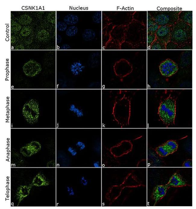 CK1 alpha Antibody in Immunocytochemistry (ICC/IF)