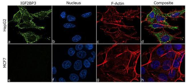 IGF2BP3 Antibody in Immunocytochemistry (ICC/IF)