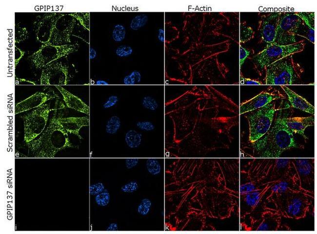 GPIP137 Antibody in Immunocytochemistry (ICC/IF)