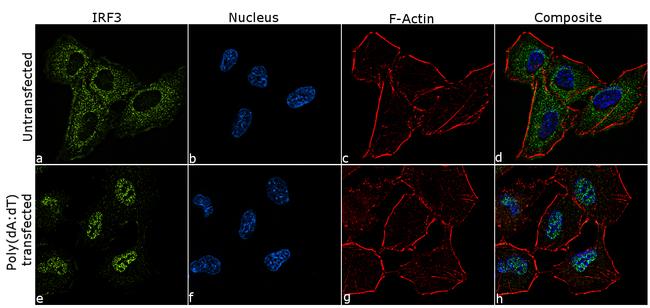 IRF3 Antibody in Immunocytochemistry (ICC/IF)