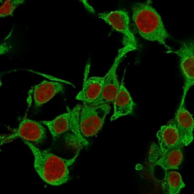 TNF-alpha (Tumor Necrosis Factor alpha) Antibody in Immunocytochemistry (ICC/IF)