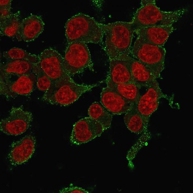 TNF-alpha (Tumor Necrosis Factor alpha) Antibody in Immunocytochemistry (ICC/IF)