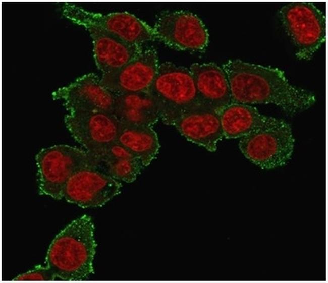 TNF-alpha (TumorNecrosis Factor alpha) Antibody in Immunocytochemistry (ICC/IF)