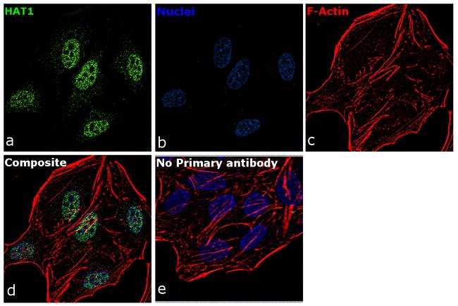 HAT1 Antibody in Immunocytochemistry (ICC/IF)