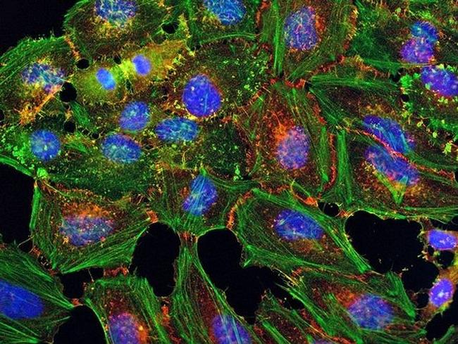 beta Catenin Antibody in Immunocytochemistry (ICC/IF)