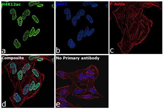 H4K12ac Antibody in Immunocytochemistry (ICC/IF)